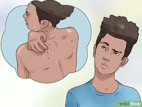 Imagen titulada Identify Mange on Dogs Step 5