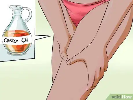 Imagen titulada Get Rid of a Rash Between Your Legs Step 8