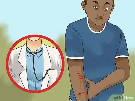 Imagen titulada Survive a Coyote Attack Step 14