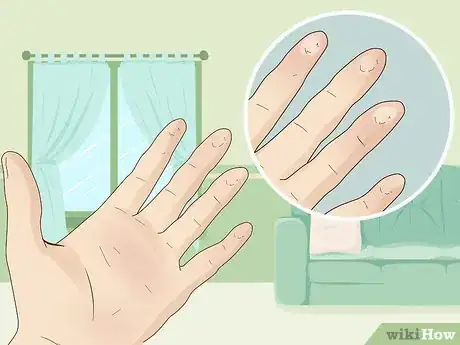 Imagen titulada Make Your Fingers Hard for Guitar Step 5.jpeg