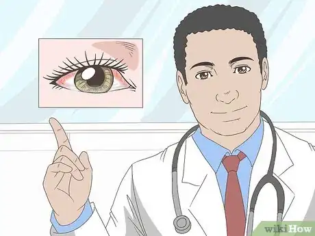 Imagen titulada Stop Watery Eyes Step 8