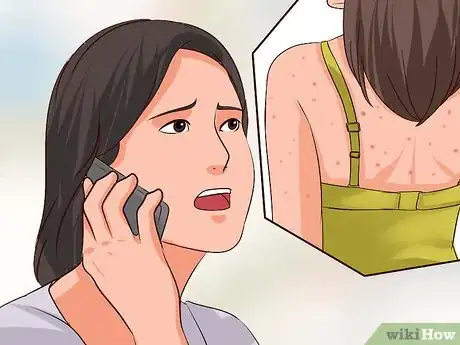 Imagen titulada Recognize Chickenpox Step 8