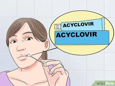 Imagen titulada Stop a Cold Sore from Growing Step 2