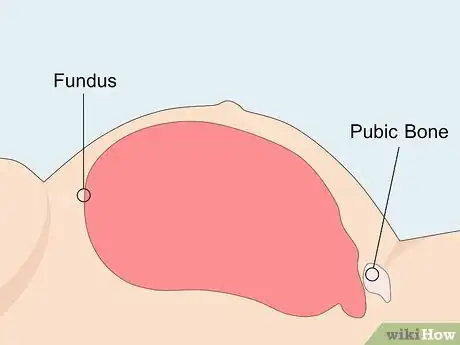 Imagen titulada Measure Fundal Height Step 13