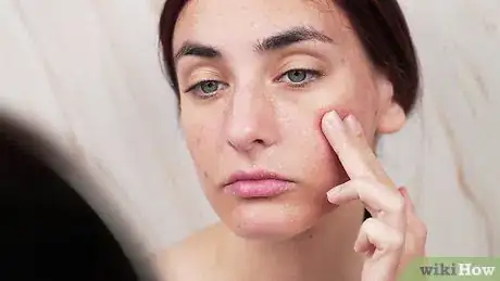 Imagen titulada Get Rid of Blackheads Using an Egg Step 10