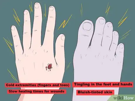 Imagen titulada Improve Blood Circulation Step 10