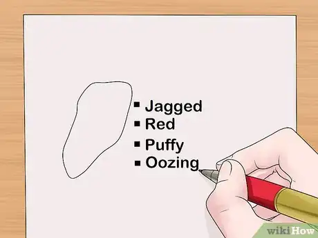 Imagen titulada Measure Wounds Step 1