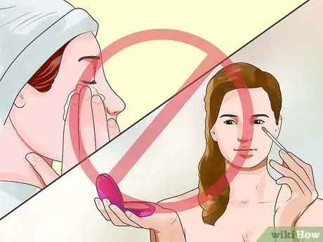 Imagen titulada Recover from Eye Surgery Step 3