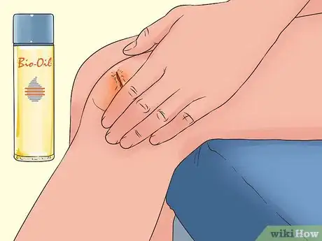 Imagen titulada Use Bio Oil Step 2