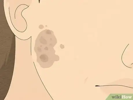 Imagen titulada Get Healthy Skin Step 18