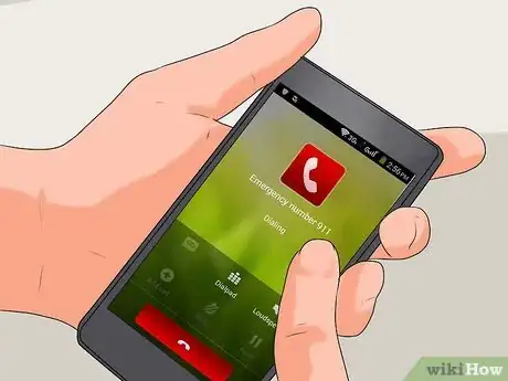 Imagen titulada Treat a Hand Burn Step 20