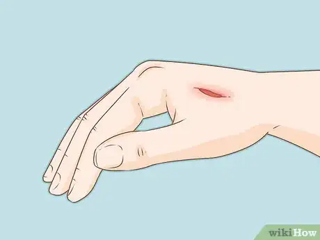 Imagen titulada Tell if Your Bird Has Mites Step 8