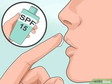 Imagen titulada Heal a Cold Sore Naturally Step 17