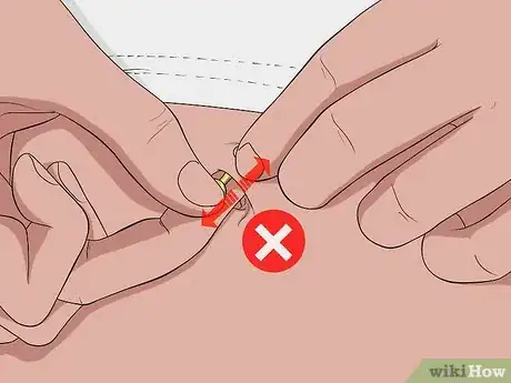Imagen titulada Treat an Irritated Belly Button Piercing Step 12