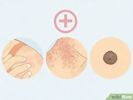 Imagen titulada Get Healthy Skin Step 19