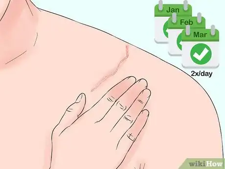 Imagen titulada Use Bio Oil Step 3