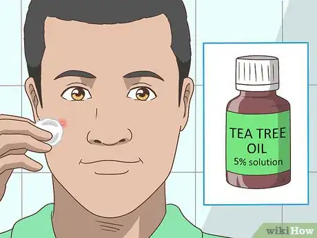 Imagen titulada Get Rid of a Pimple Step 10