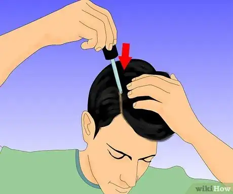 Imagen titulada Use Rogaine Step 4
