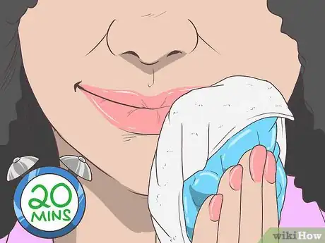 Imagen titulada Cover Up a Cold Sore Step 2