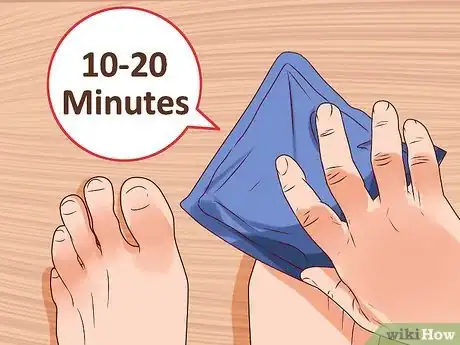 Imagen titulada Treat a Broken Pinky Toe Step 3