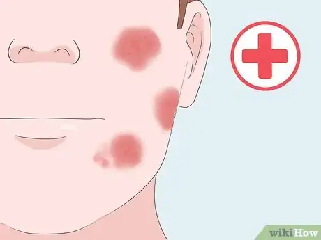 Imagen titulada Have Perfect Skin Step 18