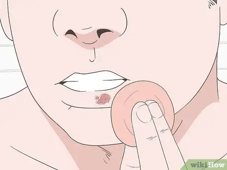Imagen titulada Cover Up a Cold Sore Step 6