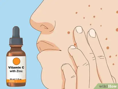 Imagen titulada Apply Vitamin C Serum for Facial Skin Care Step 7