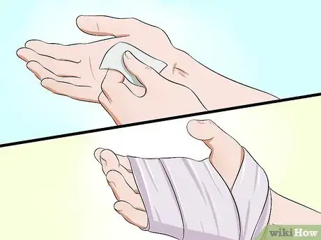 Imagen titulada Prevent Boils Step 16