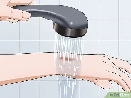 Imagen titulada Prevent Boils Step 17