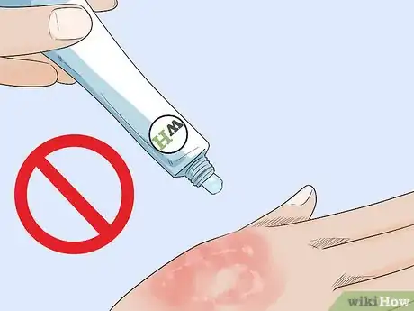 Imagen titulada Kill Fungus Step 5