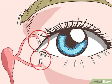 Imagen titulada Treat Dry Eyes Step 6