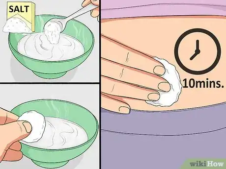 Imagen titulada Treat an Irritated Belly Button Piercing Step 11