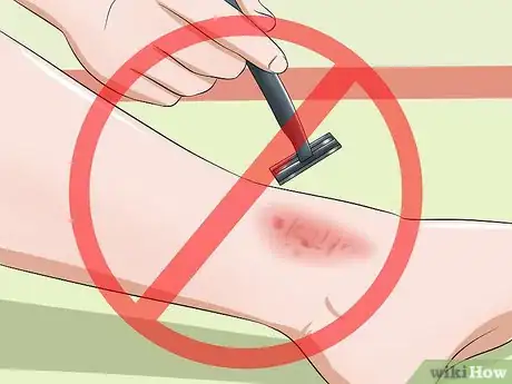 Imagen titulada Prevent Boils Step 12