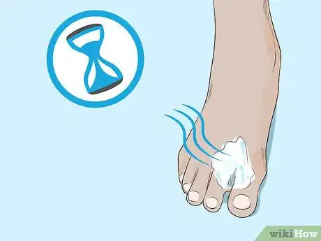 Imagen titulada Kill Fungus Step 4