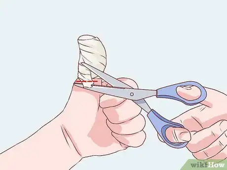 Imagen titulada Bandage Fingers or Toes Step 15