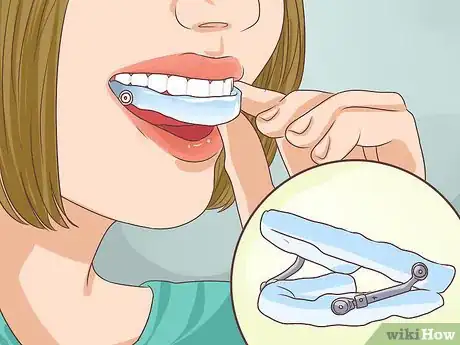 Imagen titulada Cure Sleep Apnea Step 15