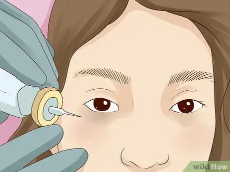 Imagen titulada Improve Under Eye Skin Step 22.jpeg