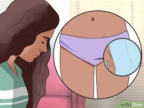 Imagen titulada Recognize Vulva Cancer Symptoms Step 3