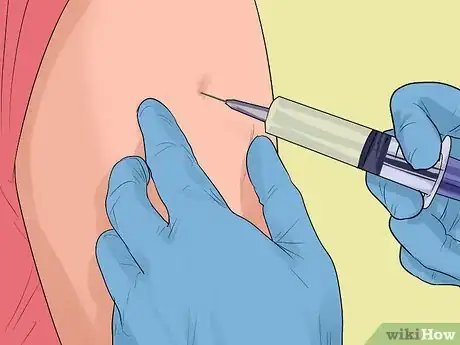 Imagen titulada Recover From a Back Injury Step 15
