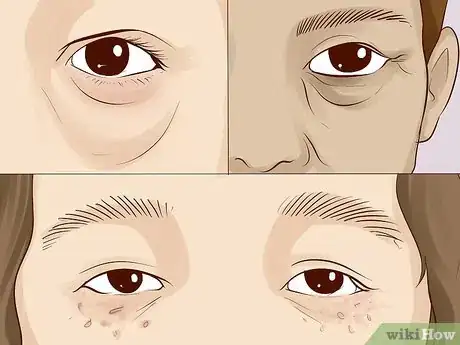 Imagen titulada Improve Under Eye Skin Step 17.jpeg