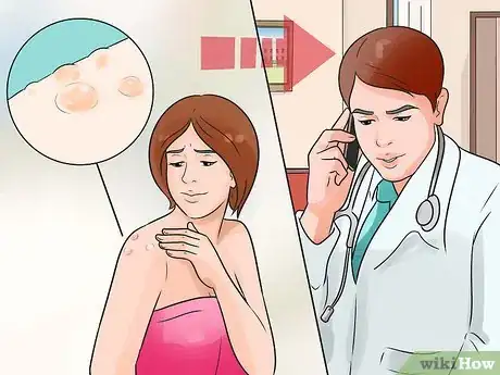 Imagen titulada Get Rid of a Sunburn Step 7