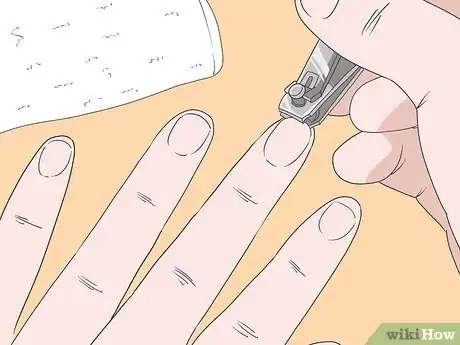 Imagen titulada Cure an Infected Finger Step 12