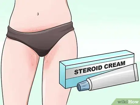 Imagen titulada Stop Vaginal Itching Step 19