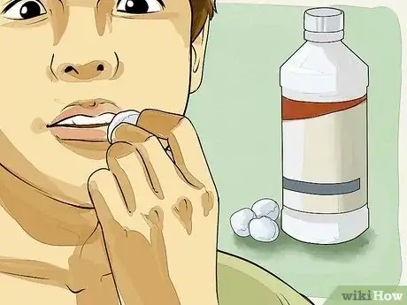 Imagen titulada Get Rid of a Cold Sore with Home Remedies Step 1