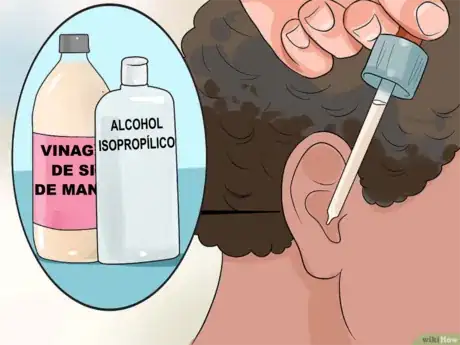 Imagen titulada Treat_a_Fungal_Ear_Infection_Step_12