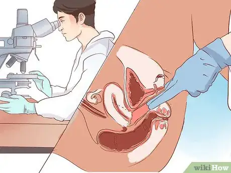 Imagen titulada Know if You Have a Yeast Infection Step 5