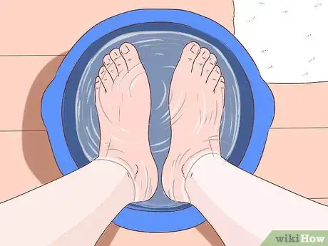Imagen titulada Get Rid of Calluses on Feet Step 1