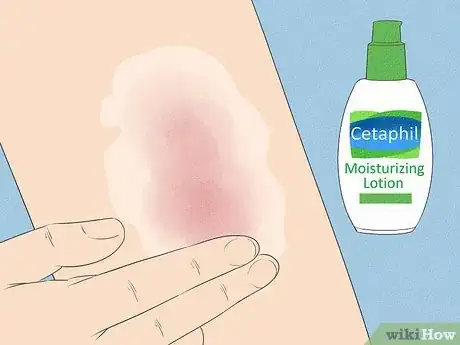 Imagen titulada Get Rid of Dry Skin Step 14