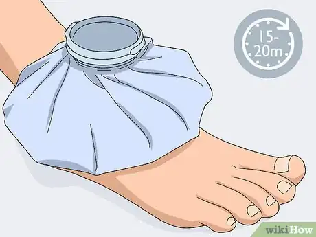 Imagen titulada Ice an Injured Ankle Step 2