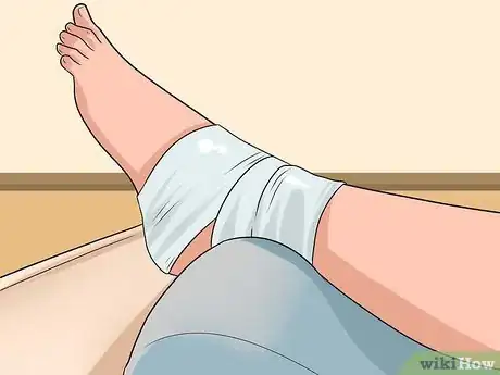 Imagen titulada Know if You've Sprained Your Ankle Step 14